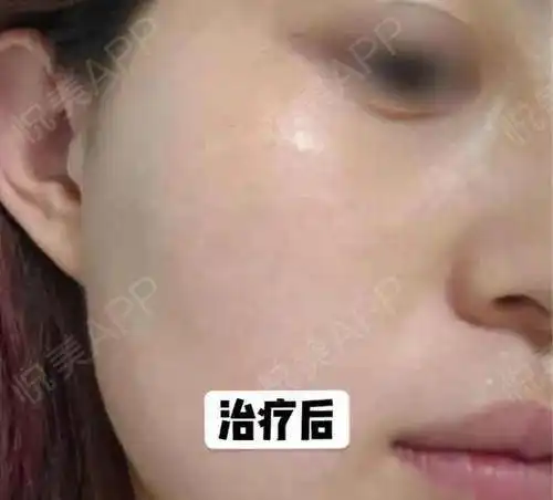 不要再问去黑眼圈最好的眼霜是哪款了嗨体你值得拥有
