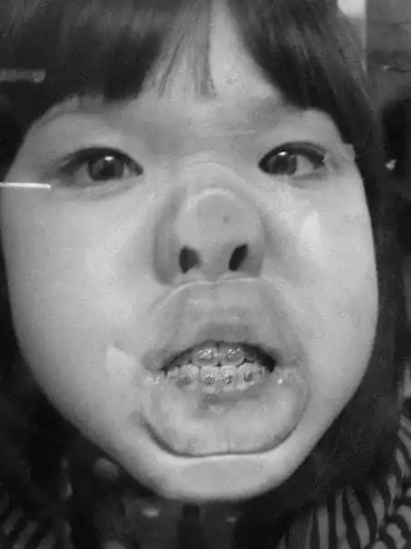 32岁女星承认整容鼻子变歪一推就动需手术修复,曾经还全身抽脂
