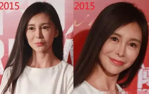 41岁薛佳凝僵脸引热议,女明星真的不要一窝蜂去搞自己的鼻子了
