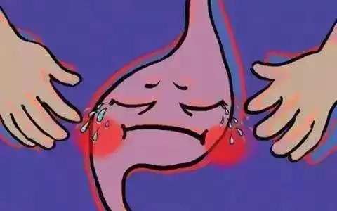 90后大学生被确诊晚期胃癌,不抽烟不喝酒,却忽视了这一种症状
