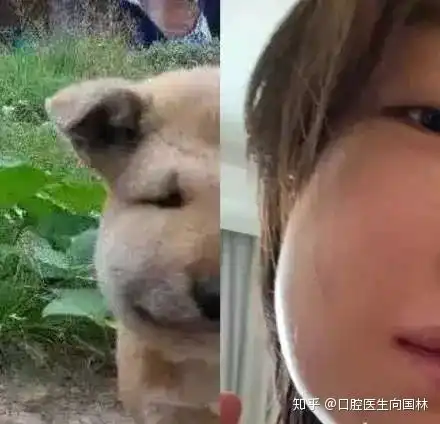 周冬雨拔智齿肿成表情包,你的智齿呢

