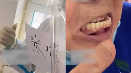 可爱高龄老人做核酸检测,假牙掉了仍坚持,大白暖心配合

