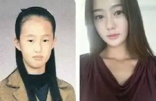 韩星整容前后惊悚对比看韩国明星到底有多丑
