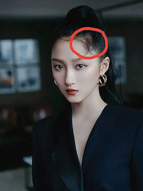 搞笑的明星发际线关晓彤引热议,赵露思惹人羡,蔡徐坤郭麒麟有对策
