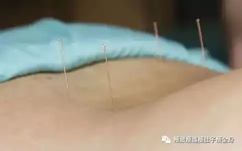 针灸减肥需要多长时间至少半年
