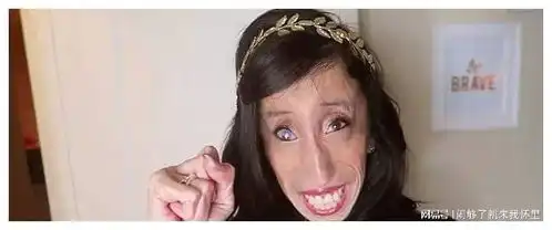 被称为世界上最丑的女人却逆袭成人生的大赢家
