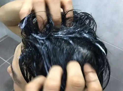 油性头发脱发怎么改善最快最有效的调理方法
