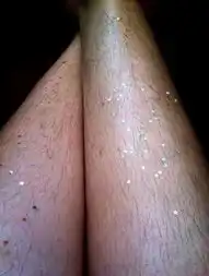 全球数千女子网上秀浓密腿毛
