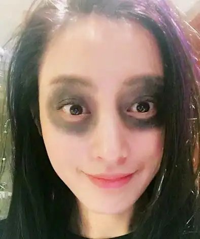 哪些不起眼的坏习惯,会让容貌发生巨大的变化你都中招了吗
