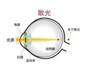 散光到底要不要治疗
