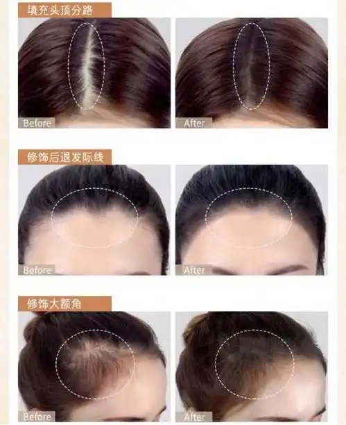 怎么让头发变多
