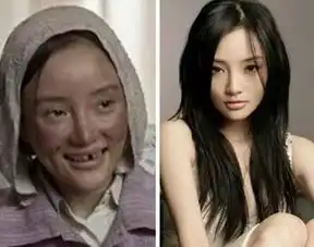 娱乐圈里哪些女明星愿意自我毁容
