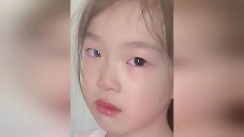 她的眼睛有星辰大海,女孩天生异瞳其中一只眼睛是蓝色

