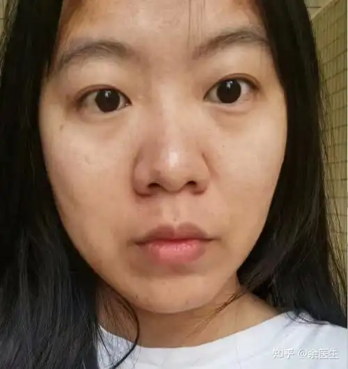 医学生是如何防止皮肤晒伤晒黑光老化的
