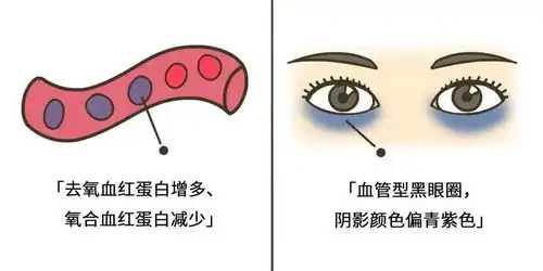讲真,不是所有的面霜,都能替代眼霜
