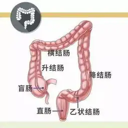 一家七口大肠生息肉,医生除了遗传还有一个主因
