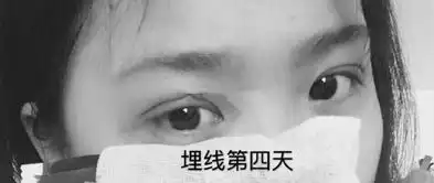 单眼皮妹子做的埋线双眼皮,变化超级大
