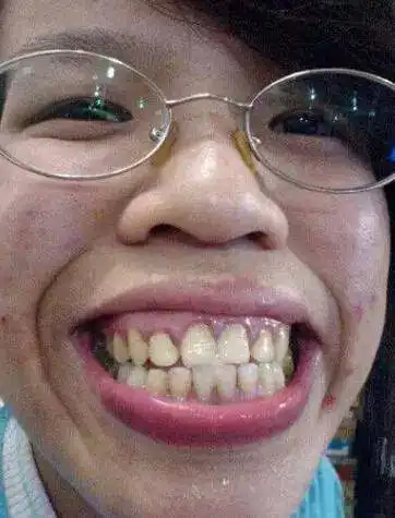 世界上丑的女人和世界上最美的女人,没有对比就没有伤害
