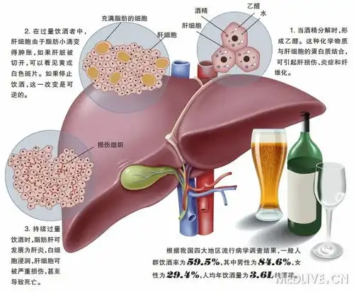 饮酒如何损伤肝脏
