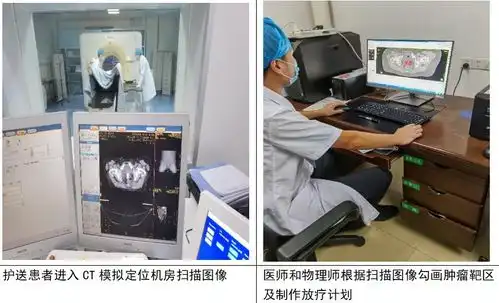 湘南地区首例3d私人订制治疗为肿瘤患者提供新选择
