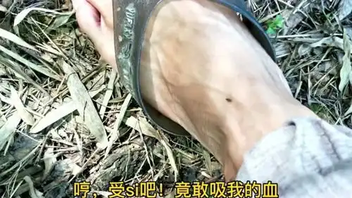 中二患者沙雕搞笑日常,户外捉虫被蚊子咬
