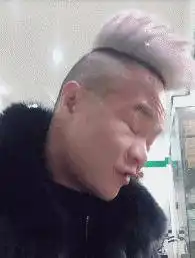 神回复脚臭去医院应该挂什么科
