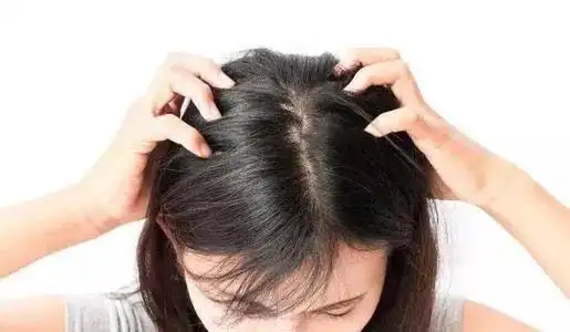 防脱发洗发水红黑榜,秃头少女不迷茫
